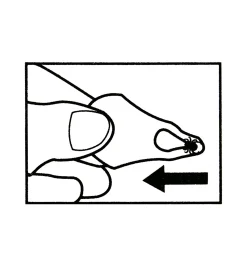 Set Of 3 Tick Key Tick Removers