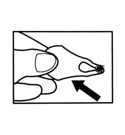 Set Of 3 Tick Key Tick Removers